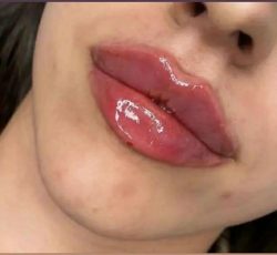 آف ژل بوتاکس ناخن