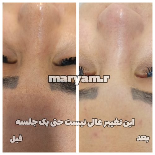 فیشال درمانی تخصصی