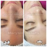 فیشال درمانی تخصصی