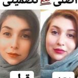 حجم دهنده طبیعی و گیاهی صورت تضمینی