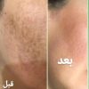 کرم سفیدکننده وی ای فی