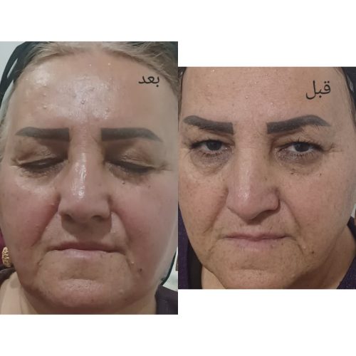 مدل بافت و مدل پاکسازی