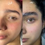 لیفت و لمینت مژه و ابرو