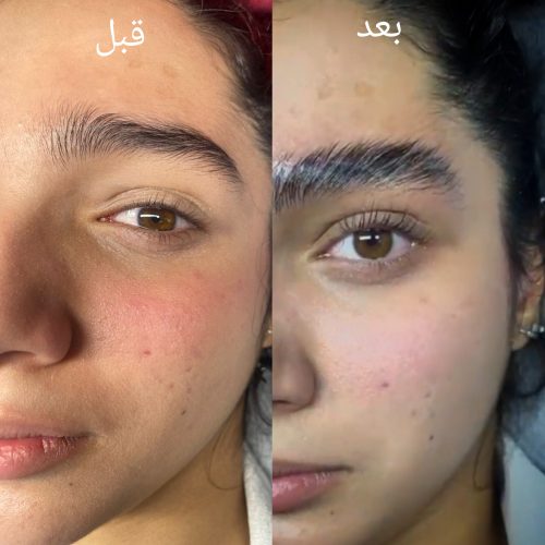 لیفت و لمینت مژه و ابرو