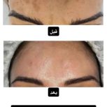 کرم معجزه چهل گیاه تضمینی