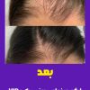معجزه قطع ریزش مو در 30روز/مو/ریش/پوست
