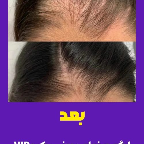 معجزه قطع ریزش مو در 30روز/مو/ریش/پوست