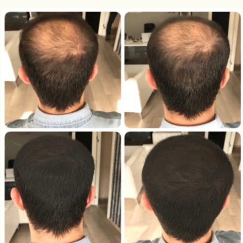 معجزه قطع ریزش مو در 30روز/مو/ریش/پوست