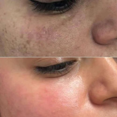 کرم سفیدکننده وی ای فی