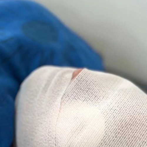 فشیال و پاکسازی