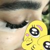 کاشت مژه هیدن
