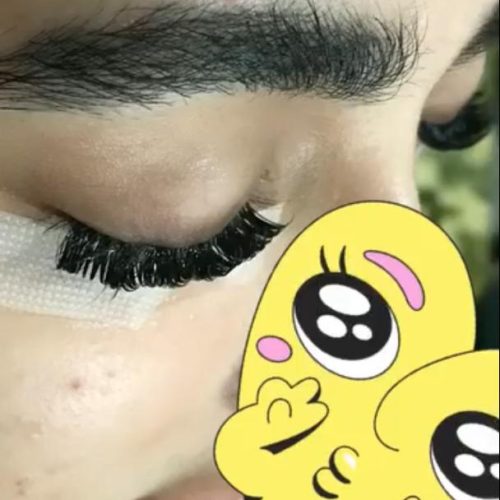 کاشت مژه هیدن