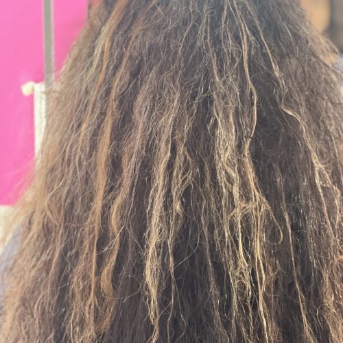 کراتین ،احیاو بوتاکس