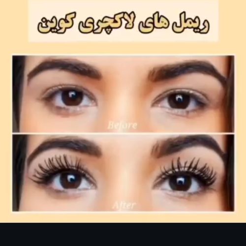 ارایشی بهداشتی کوین