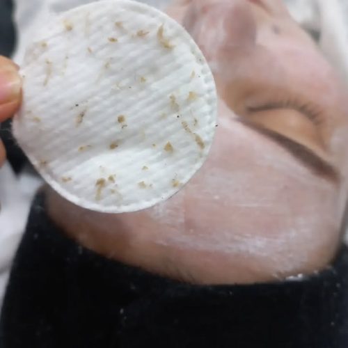 فشیال و پاکسازی