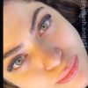 کاشت مژه هیدن