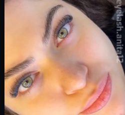 کاشت مژه هیدن