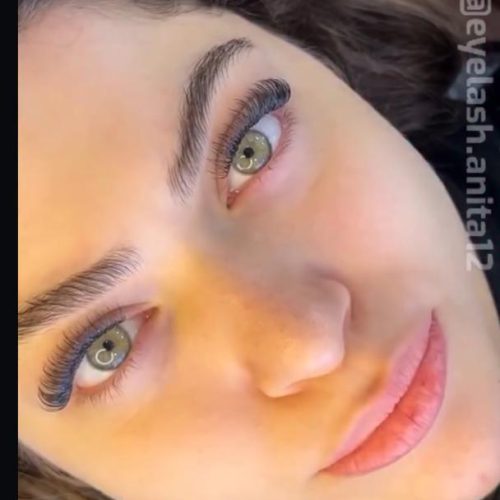 کاشت مژه هیدن