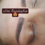 فیبروز و میکرو ابرو