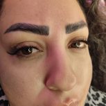 اکستنشن مژه