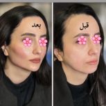 جشنواره تخفیفی پایان تابستان کلینیک زیبایی ولیزر