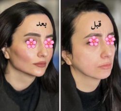 جشنواره تخفیفی پایان تابستان کلینیک زیبایی ولیزر