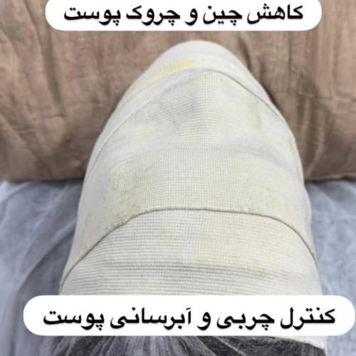 پاکسازی و فشیال