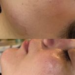فیشال و پاکسازی