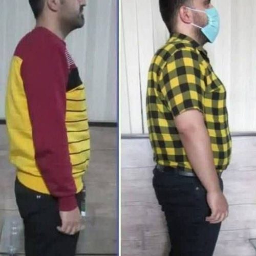 چربی سوزی و تناسب اندام