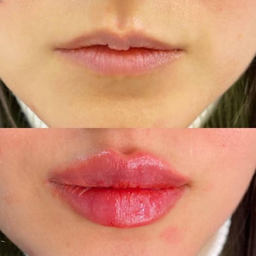 آموزش صفر تا صد تزریقات و زیبایی و مدرک معتبر