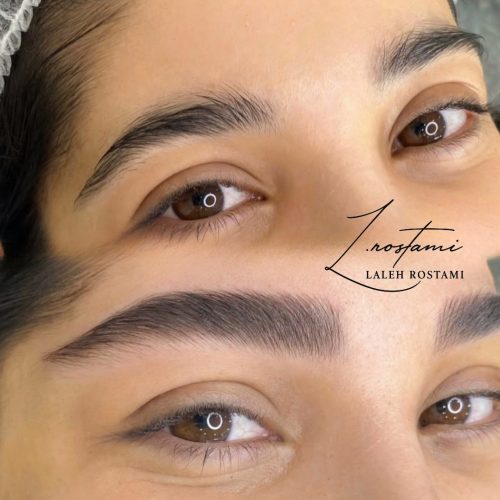 میکروبلیدینگ ابرو