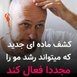 کچلی درمان شد😨