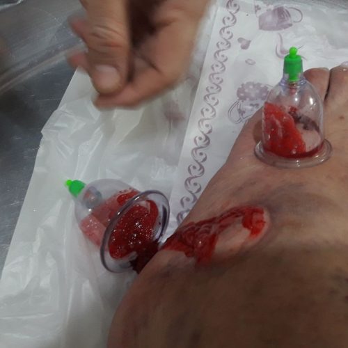 طب الحسین110درمان تخصصی دیسک کمر