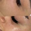 فیشال و پاکسازی