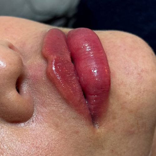 خدمات زیبایی ژل و بوتاکس