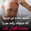 کچلی درمان شد