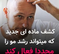 کچلی درمان شد