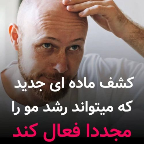 کچلی درمان شد