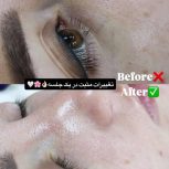 پاکسازی و فشیال