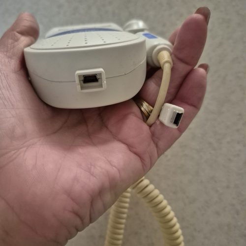 داپلر ضربان قلب جنین