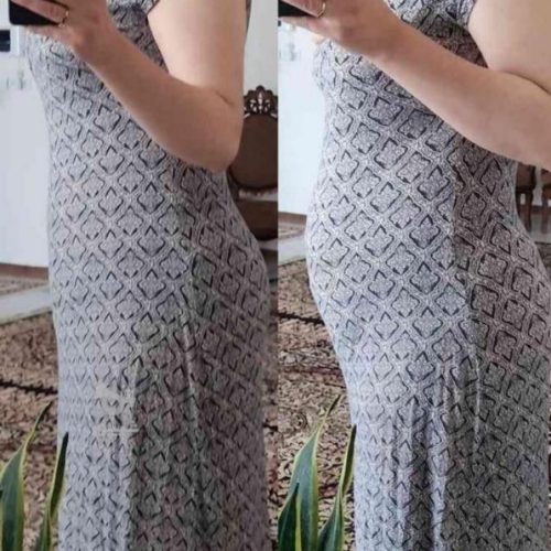 نمایندگی فروش گن های لاغری و درمانی