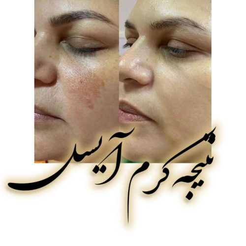 کرم شب ایسل پلاس سفیدکننده ضدلک ضدجوش صددرصدضمانتی