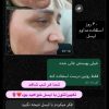 کرم شب ایسل پلاس سفیدکننده ضدلک ضدجوش صددرصدضمانتی