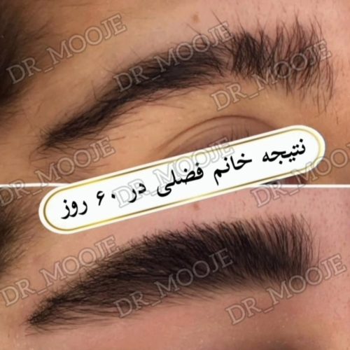 مژه وابرو طبیعی داعم