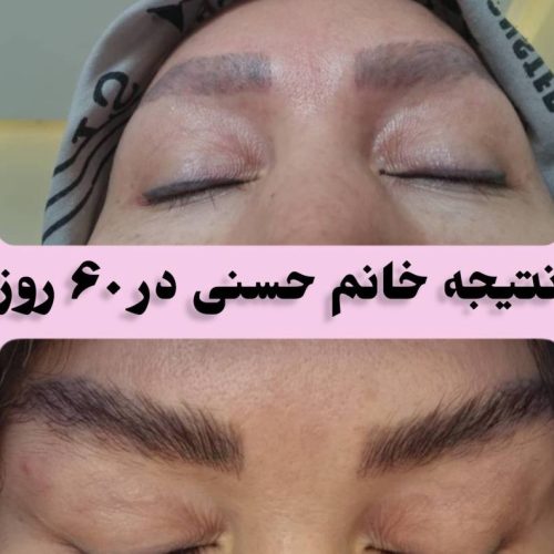 مژه وابرو طبیعی داعم