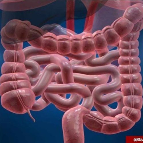 برای همیشه با یبوست خداحافظی کن