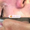 فیشال و پاکسازی پوست آقایون و بانوان