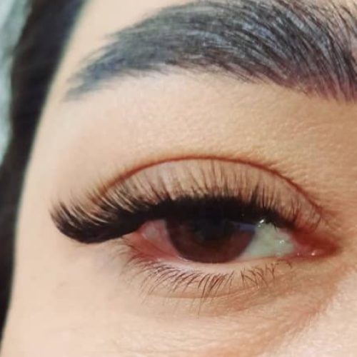 کاشت مژه