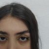 لیفت و لمینت و بوتاکس مژه و ابرو