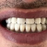 لابراتوار دندانسازی